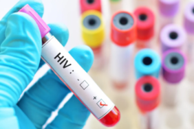 HIV Enfeksiyonlarını Neredeyse Tamamen Önleyen İlaca Onay Yolda: Lenacapavir 3 Ekran görüntüsü 2024-12-03 180650