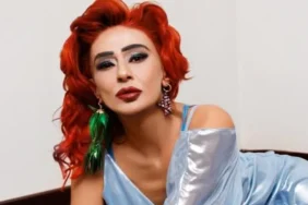 Yıldız Tilbe, Saç Boyasından Sonra Yüzünün Yandığını Açıkladı 2 7