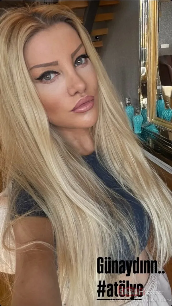 0x0-9-saatlik-operasyon-gecirmisti-modaci-gulsah-saracoglunun-yeni-paylasimi-sasirtti-1748780194817